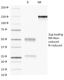 Progesterone R/NR3C3 Antibody (PR484), Novus Biologicals 0.2mg; Unlabeled:Antibodies,